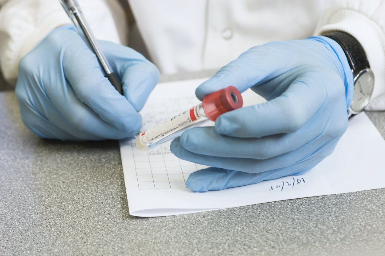 Cercetătorul care a dezvoltat primul test rapid de salivă pentru depistarea coronavirusului a murit la 51 de ani