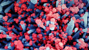 Celulă-afectată-de-coronavirus