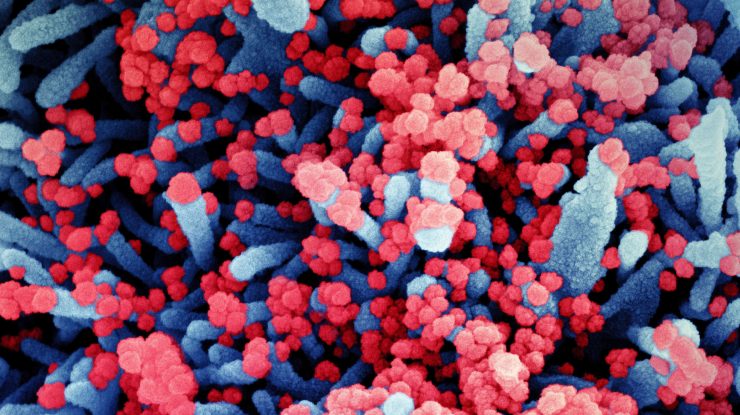 Celulă-afectată-de-coronavirus