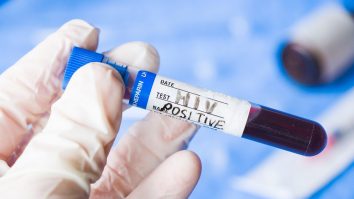 Un nou studiu dă speranțe de vindecare celor infectați cu HIV. Terapia folosită de cea de-a doua persoană care a scăpat vreodată de virus