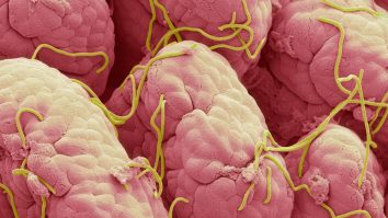 Oamenii de știință au identificat peste 70.000 de virusuri necunoscute în intestinul uman