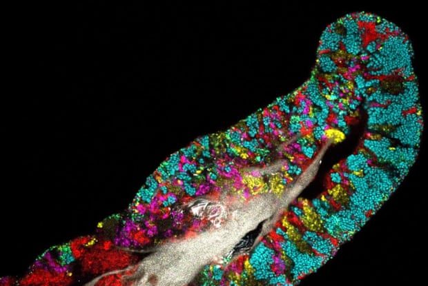 Limba-umană-cu-mai-multe-tipuri-de-microbi