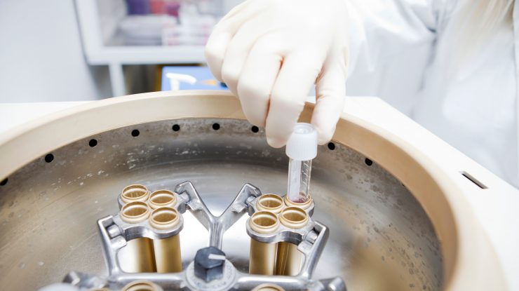 Problemă națională în Suedia: Țara se confruntă cu deficitul de spermă. Pandemia ține donatorii departe de clinici