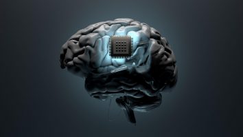 Neuralink a testat activitatea cerebrală a unei maimuțe. Care este scopul experimentului