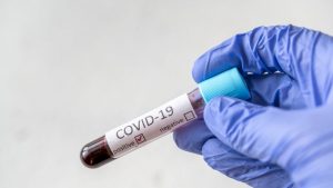Mostră de sânge pentru testarea COVID-19.