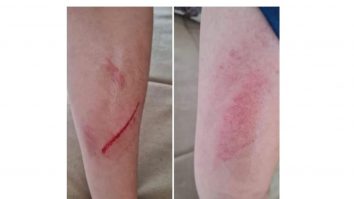 Un copil a fost lovit și umilit de colegi, „pe motiv că este grăsuț”. Poliția a deschis o anchetă