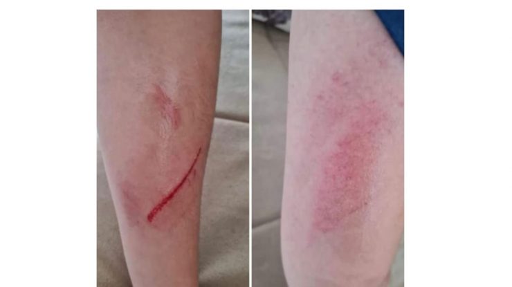 Un copil a fost lovit și umilit de colegi, „pe motiv că este grăsuț”. Poliția a deschis o anchetă