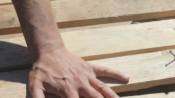 Aspectul unghiilor îți dezvăluie dacă ai avut sau nu boala COVID. Ce a descoperit un epidemiolog renumit