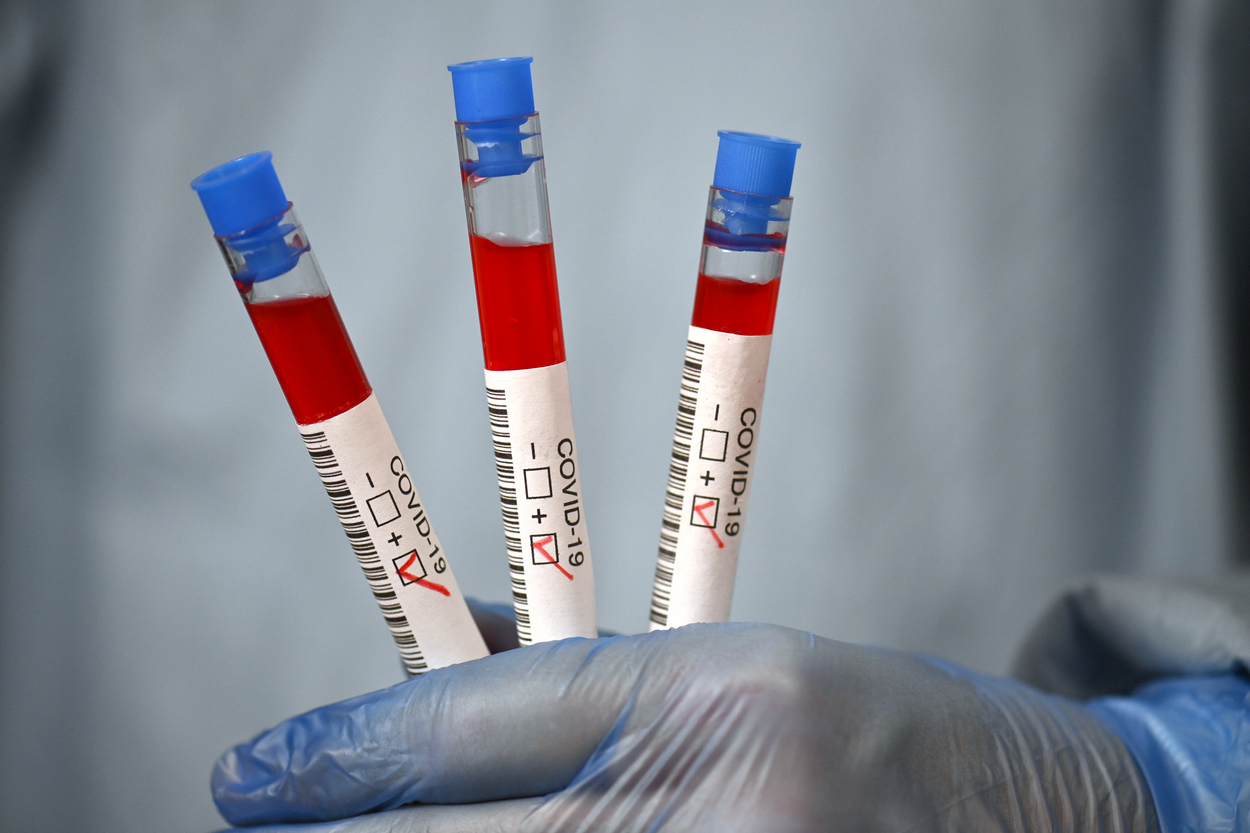 Bilanțul zilei. 30 de cazuri de coronavirus și 3 decese, raportate în ultimele 24 de ore