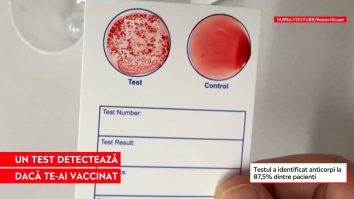 Testul care poate detecta persoanele vaccinate: Pui o picătură de apă pe card