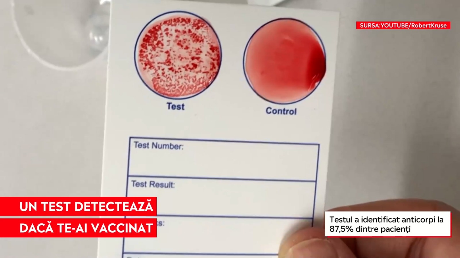 Testul care poate detecta persoanele vaccinate: Pui o picătură de apă pe card