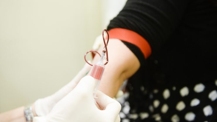 Pandemia a afectat lupta cu HIV/SIDA