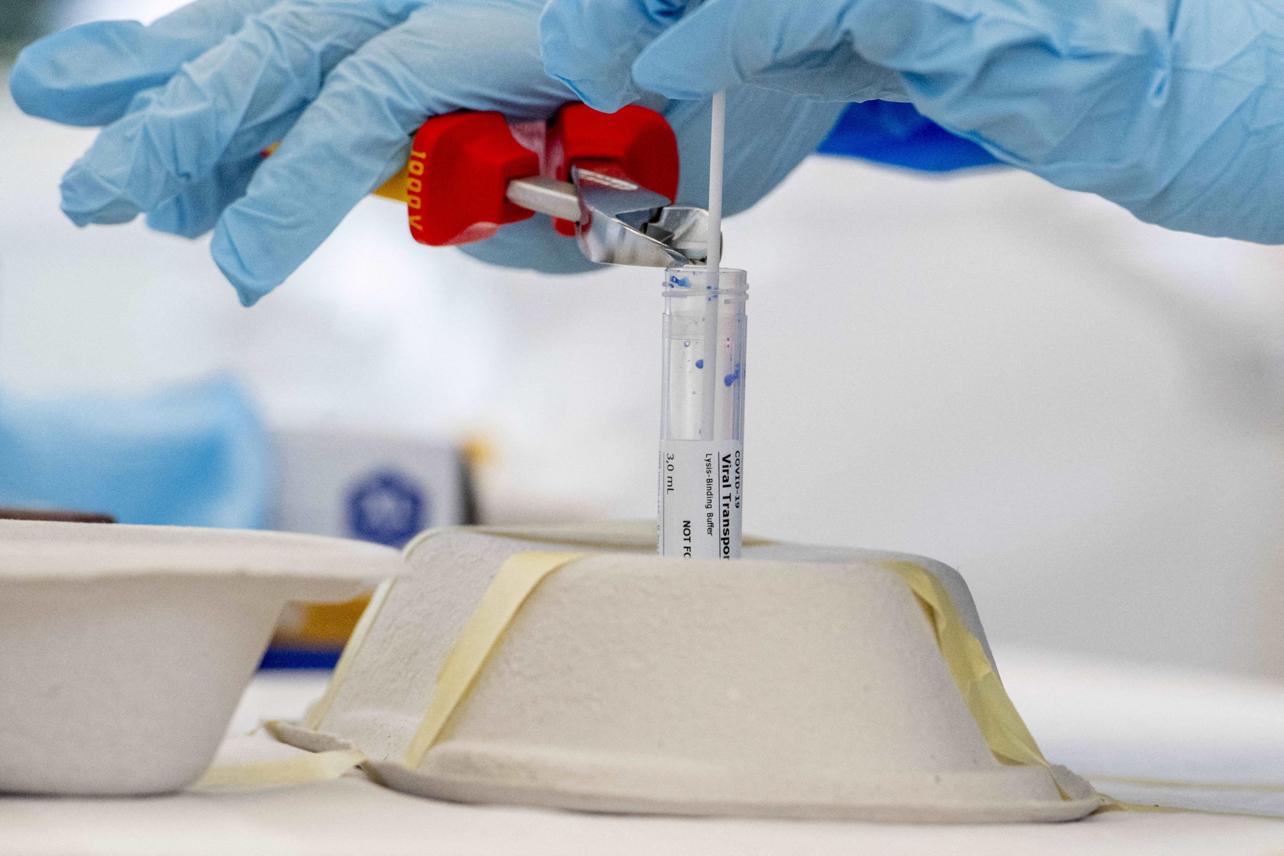 Încărcătura virală provocată de varianta Delta este de 300 de ori mai mare faţă de varianta iniţială. Explicația cercetătorilor sud-coreeni