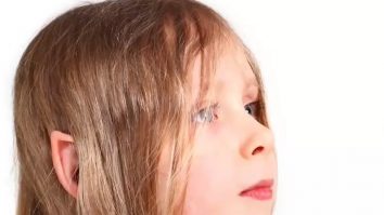 Urechile de elf, noul trend din China. Operația estetică face furori printre tineri