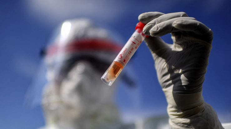 Medic care ține în mână un test COVID.