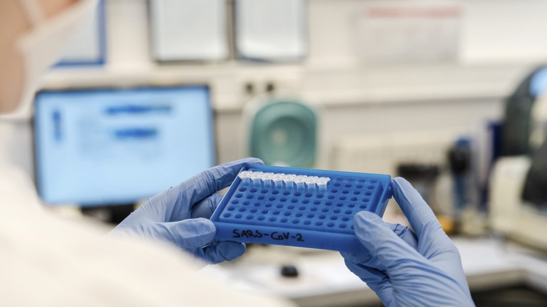Processing Covid-19 samples. Microbiologist preparing samples for PCR (polymerase chain reaction) testing for infection with the new coronavirus SARS-CoV-2. SARS-CoV-2 causes a respiratory infection (Covid-19) that can lead to fatal pneumonia. PCR uses primers that attach to any viral genetic material in the sample and amplify it so that it can be detected.,Image: 517339134, License: Rights-managed, Restrictions: , Model Release: no