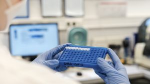 Processing Covid-19 samples. Microbiologist preparing samples for PCR (polymerase chain reaction) testing for infection with the new coronavirus SARS-CoV-2. SARS-CoV-2 causes a respiratory infection (Covid-19) that can lead to fatal pneumonia. PCR uses primers that attach to any viral genetic material in the sample and amplify it so that it can be detected.,Image: 517339134, License: Rights-managed, Restrictions: , Model Release: no