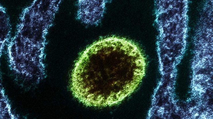 virusul nipah la microscop