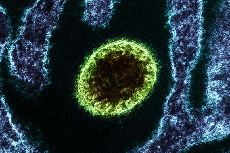 virusul nipah la microscop