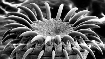 Medicii au descoperit o tenie în creierul unui bărbat la zeci de ani după ce acesta a consumat carne infectată cu fecale