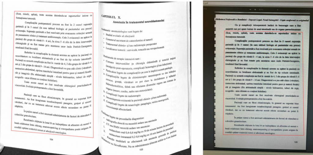 Dr. Radu Bălănescu: „Autopsia unei cariere”.Câți bani publici câștigă azi un plagiator