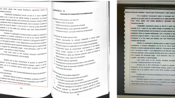 Dr. Radu Bălănescu: „Autopsia unei cariere”.Câți bani publici câștigă azi un plagiator