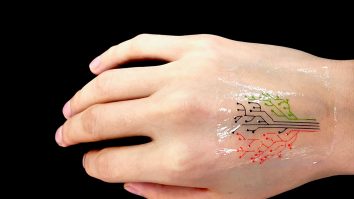 Microcip implantat în piele, pe post de certificat COVID, noua invenție din Suedia