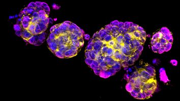 STUDIU. De ce crește numărul persoanelor sub 50 de ani care au cancer