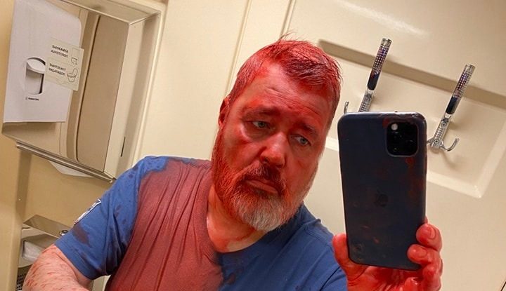 Un jurnalist rus a fost atacat în tren. Agresorul a răzbunat victimele ucrainene