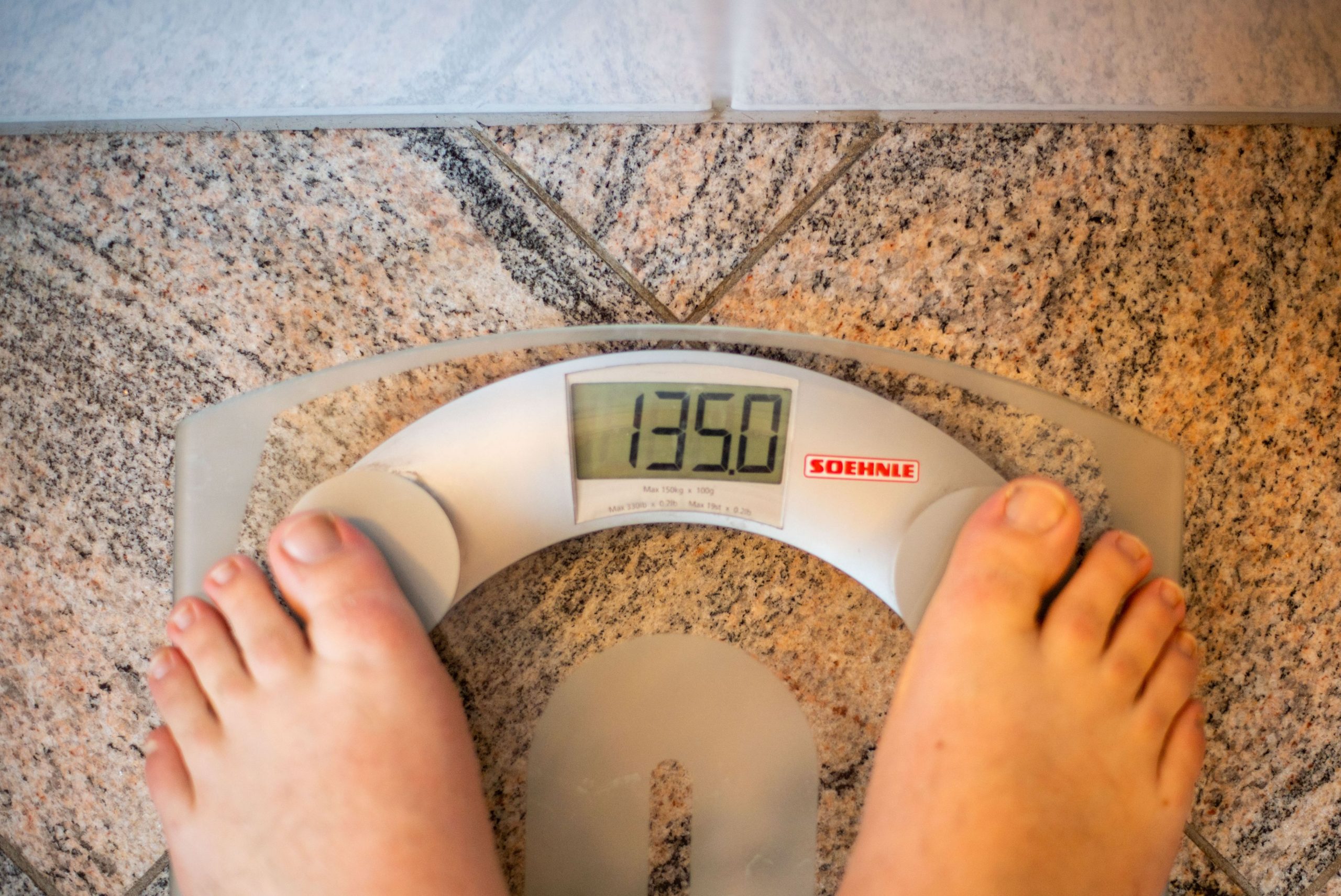 Obezitatea afectează grav Europa. Peste 1 milion de decese anual