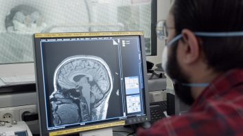 STUDIU. Inteligența artificială îți poate ghici ideologia politică doar cu o scanare a creierului