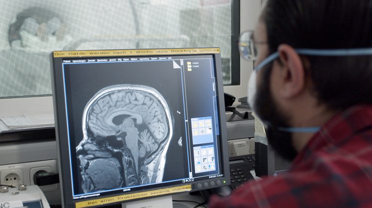 Fumătorii care au suferit accidente vasculare cerebrale au scăpat de dependență. Cercetătorii studiază fenomenul