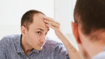 Primul transplant de păr cu tehnologia NeoGraft a fost făcut la Brașov