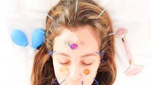 Cercetătorii au descoperit că acupunctura ajută la reducerea durerilor de cap