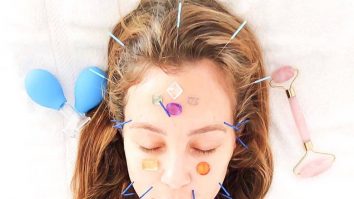 Cercetătorii au descoperit că acupunctura ajută la reducerea durerilor de cap