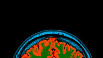 Noi progrese științifice făcute de I.A. DeepMind descoperă structura a 200 de milioane de proteine