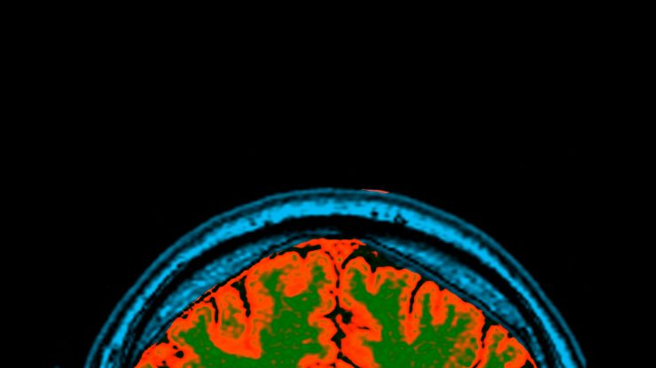 Noi progrese științifice făcute de I.A. DeepMind descoperă structura a 200 de milioane de proteine