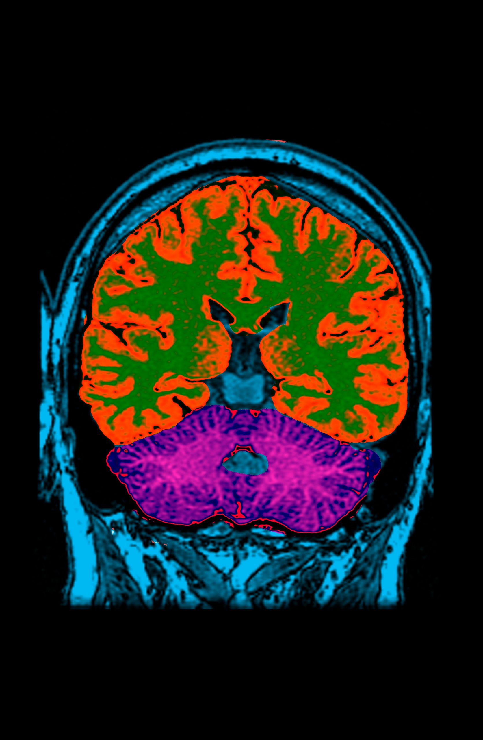 Noi progrese științifice făcute de I.A. DeepMind descoperă structura a 200 de milioane de proteine