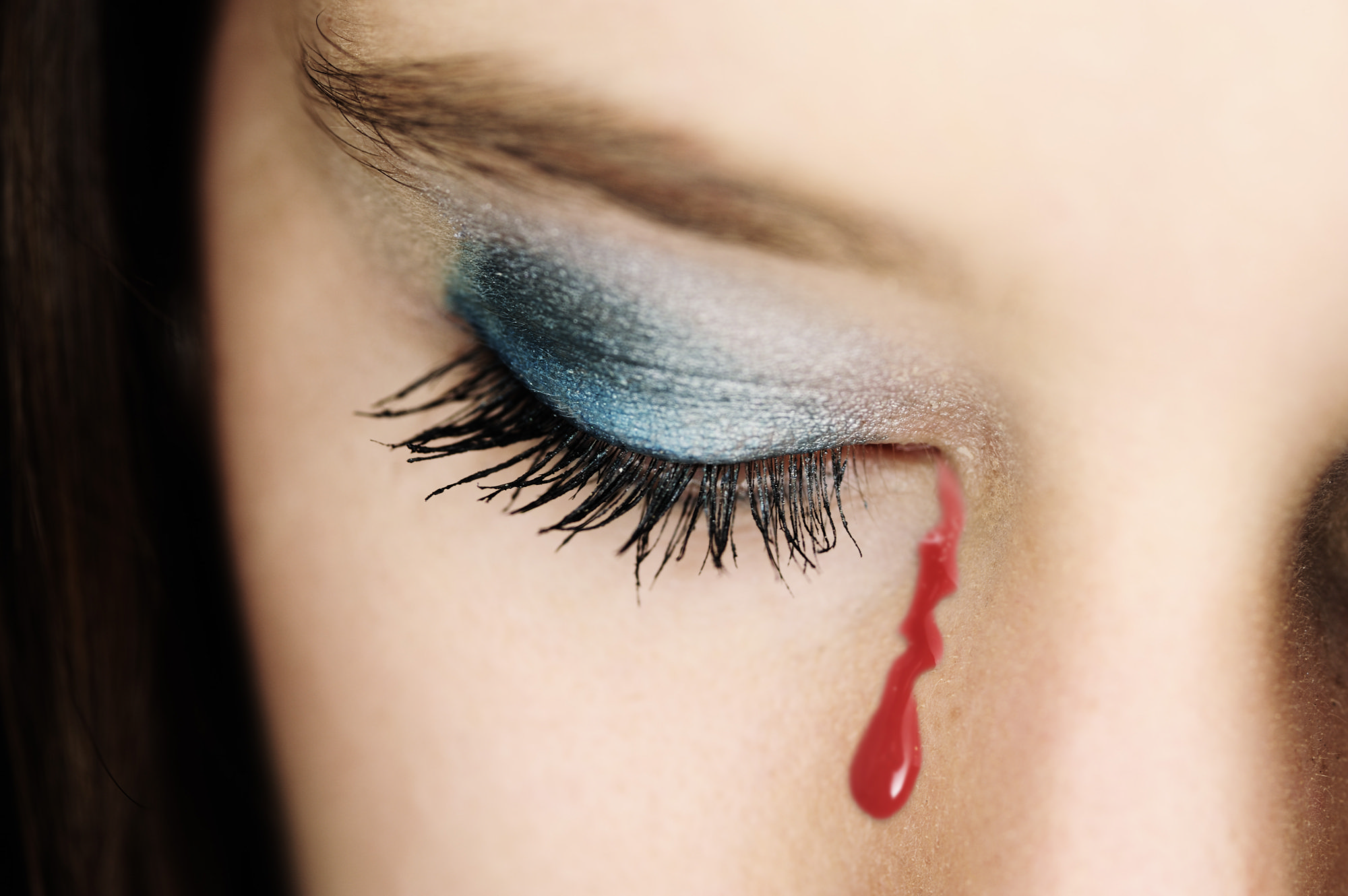 Virusul mortal al hemoragiei oculare care ucide până la o treime din pacienți ajunge în Europa