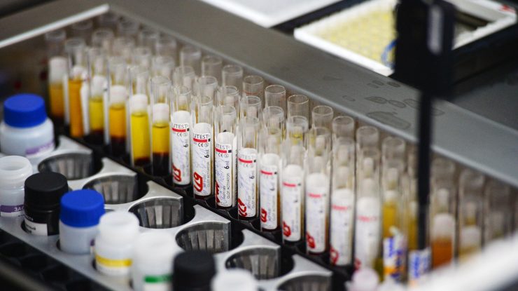 Experții britanici cred că au identificat sursa pentru cazurile misterioase de hepatită la copii