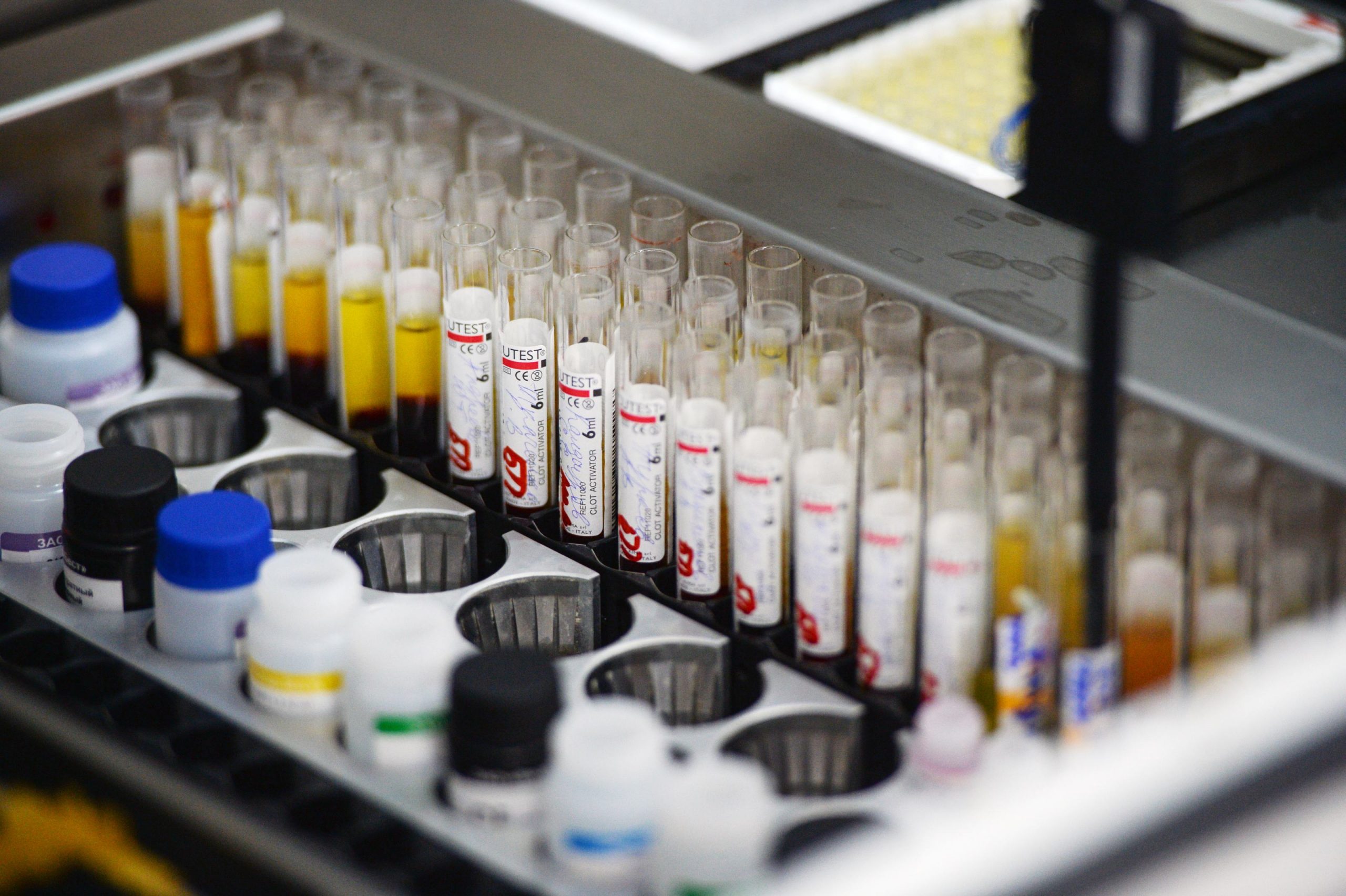 Experții britanici cred că au identificat sursa pentru cazurile misterioase de hepatită la copii