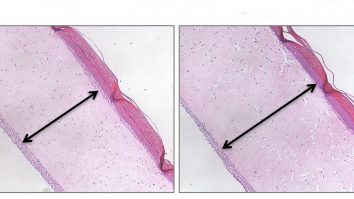 Lucruri pe care ar trebui să le știi despre dieta cu colagen