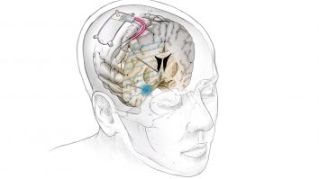 O nouă cercetare arată că teoria care justifică antidepresivele este doar un mit