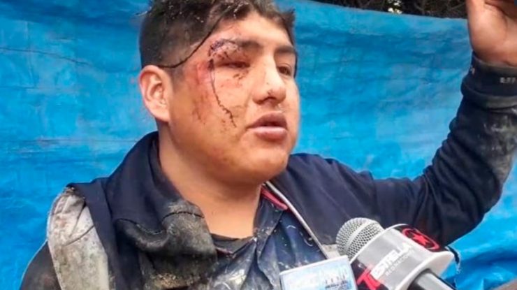 VIDEO. Un bărbat a mers la o petrecere cu prietenii și s-a trezit îngropat de viu într-un sicriu