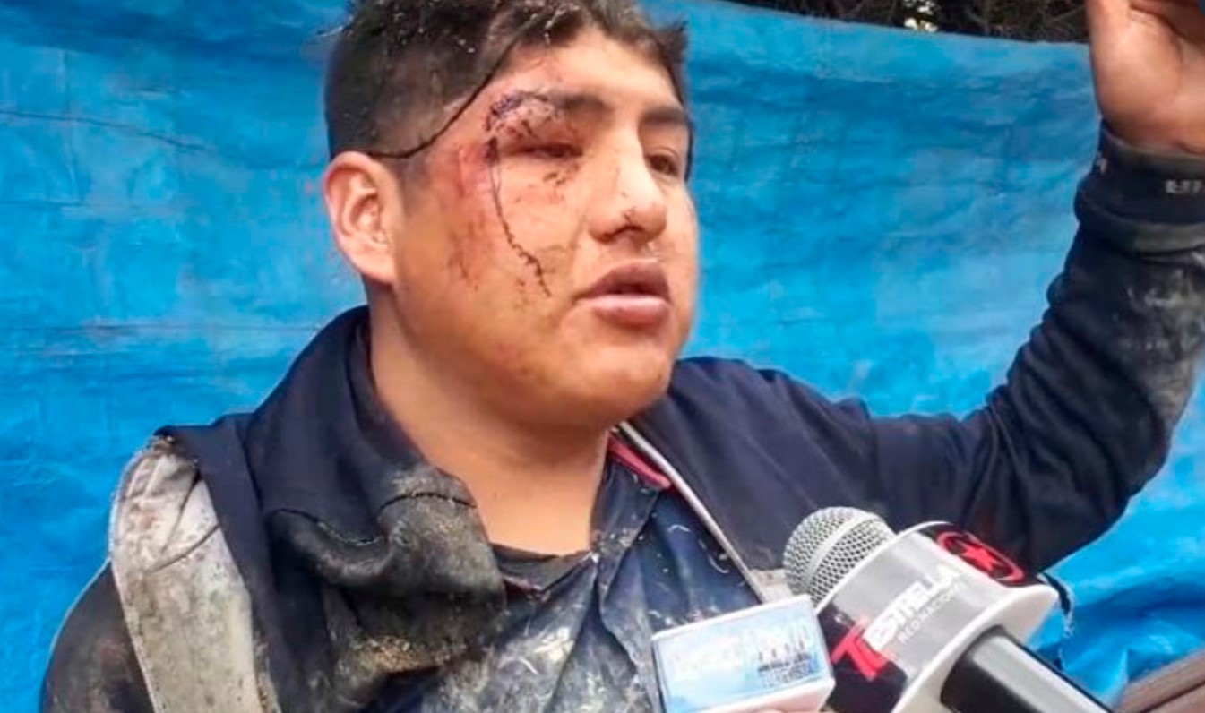 VIDEO. Un bărbat a mers la o petrecere cu prietenii și s-a trezit îngropat de viu într-un sicriu