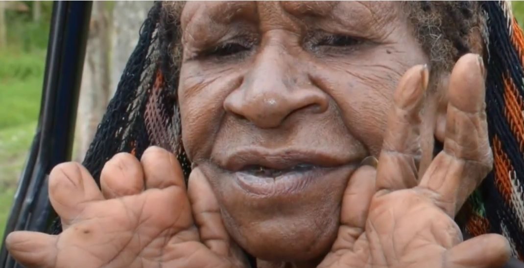 De ce unii membri ai tribului Dani din Papua, Noua Guinee își mutilează degetele în semn de doliu