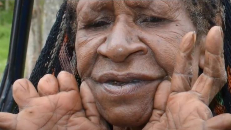 De ce unii membri ai tribului Dani din Papua, Noua Guinee își mutilează degetele în semn de doliu