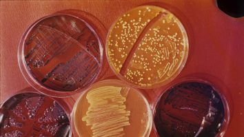 Bacteria „Legionella” a fost identificată ca fiind cauza unor misterioase epidemii de pneumonie în Argentina