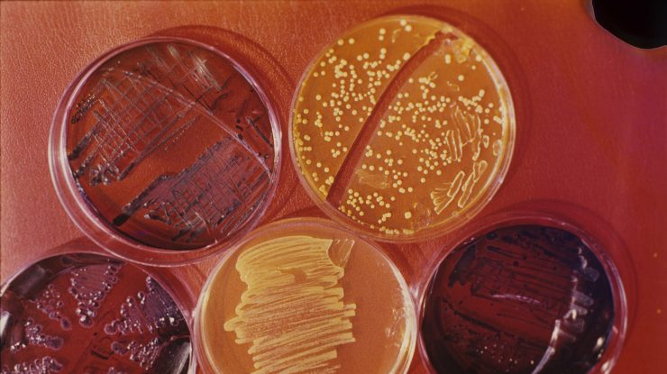 Bacteria „Legionella” a fost identificată ca fiind cauza unor misterioase epidemii de pneumonie în Argentina