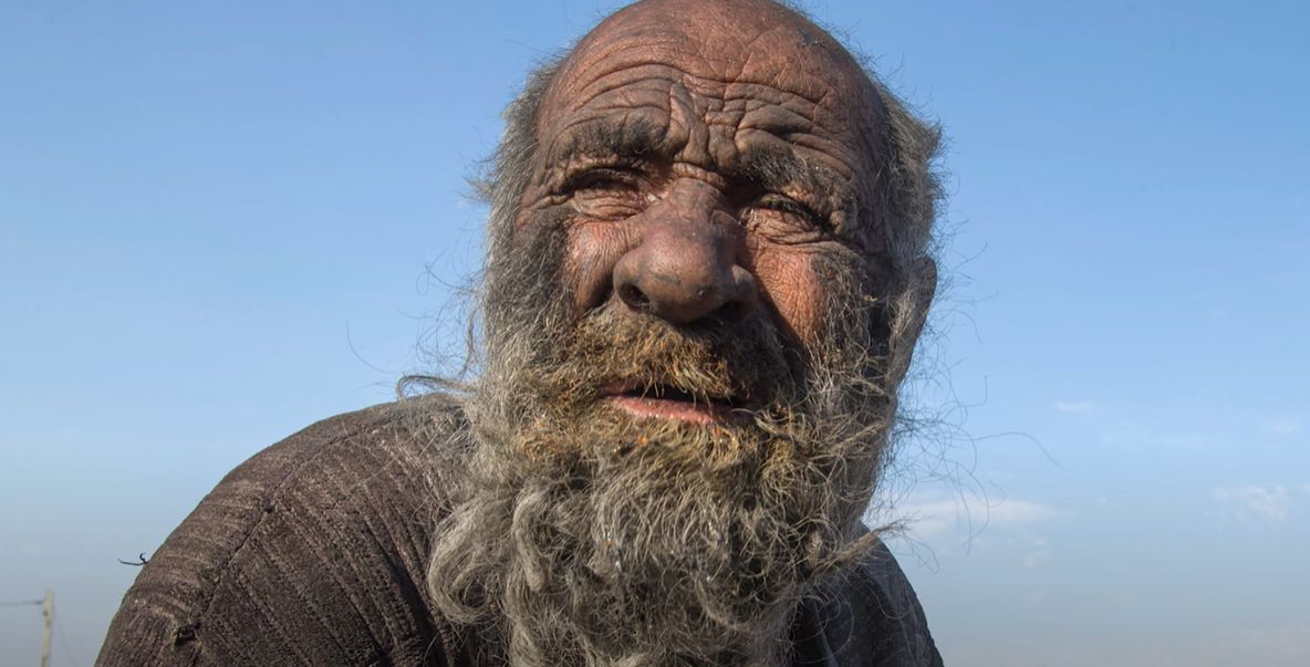 VIDEO. Nu a facut baie în ultimii 50 de ani de teama de a „nu se îmbolnăvi”, însă acum a murit. Cum arata cel mai murdar om din lume